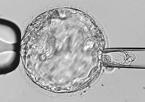 做过两次剖腹产后可以做供卵试管三代的双胞胎吗？