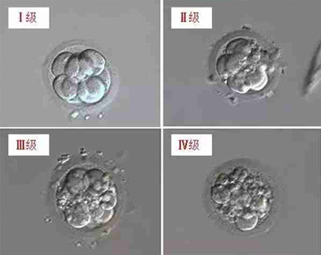 温医大附一院做供卵试管婴儿移植囊胚需要多少钱
